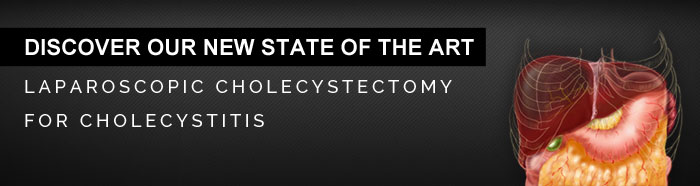 Laparoscopic cholecystectomy for cholecystitis