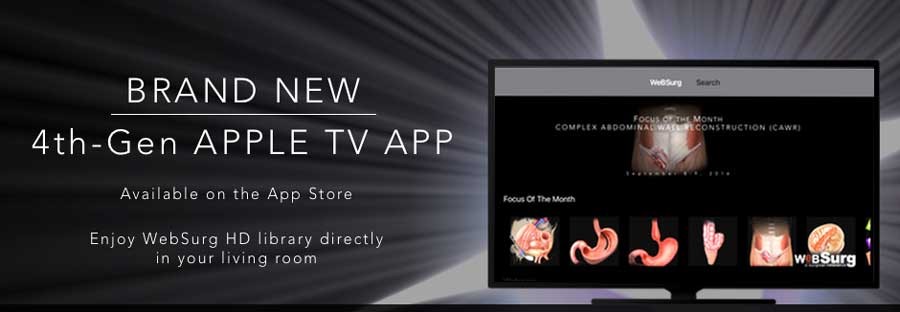 4th gen Apple TV App available