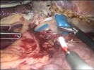 Videos of live surgery