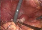 Videos of live surgery